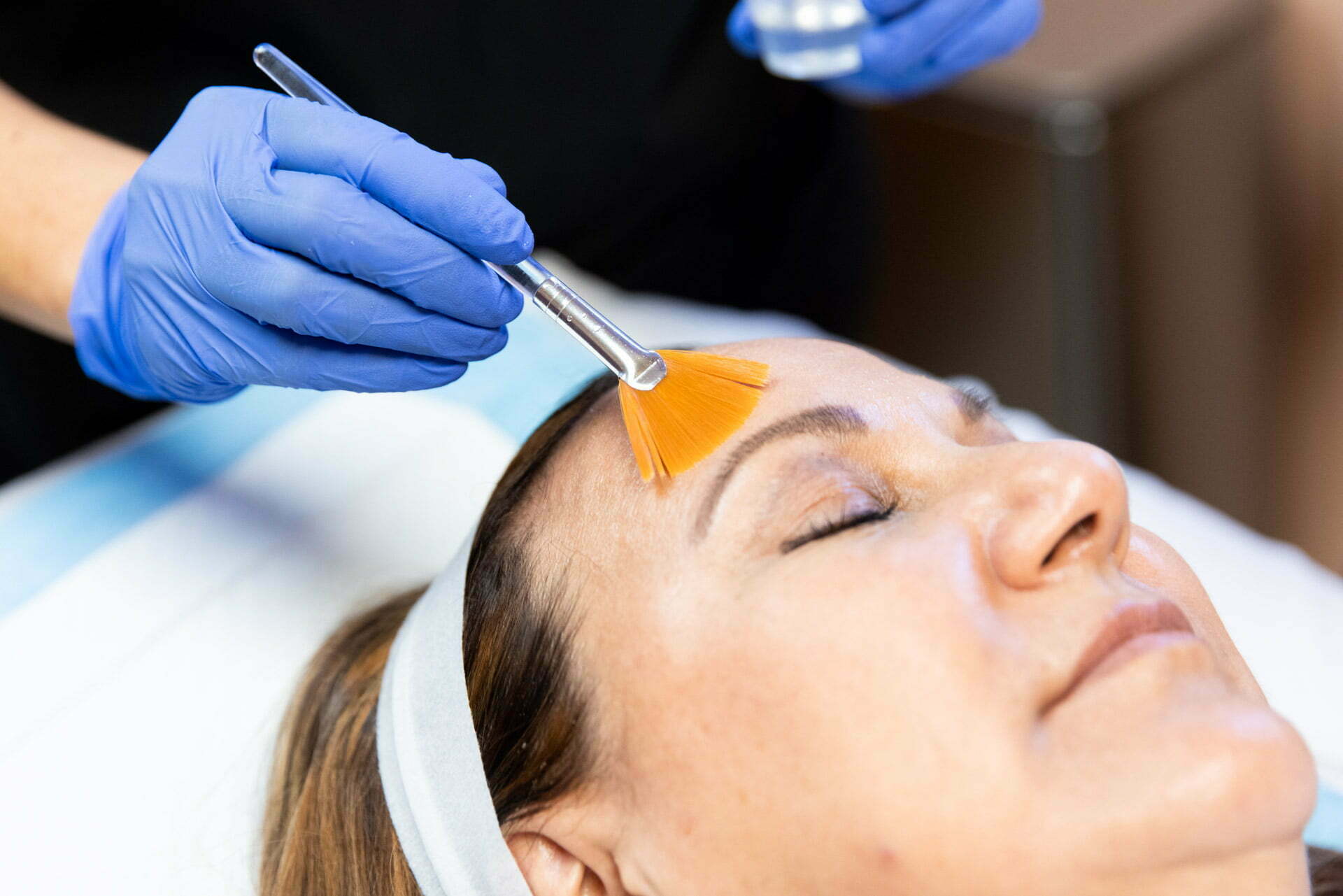 Which Face Peel Is Right for Your Skin? - Spa MDSpa MD