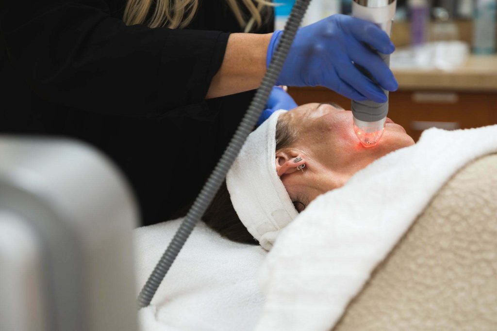Microneedling and RadioFrequency 